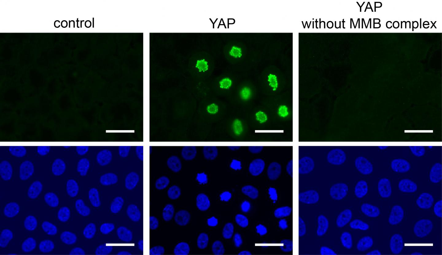 YAP-MMB-Action