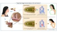 Typical Food Triggers Immune Tolerance in the Small Intestine (1 of 2)