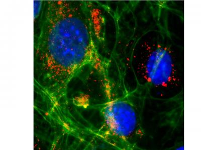 Cerebral Endothelial Cells in Cell Culture