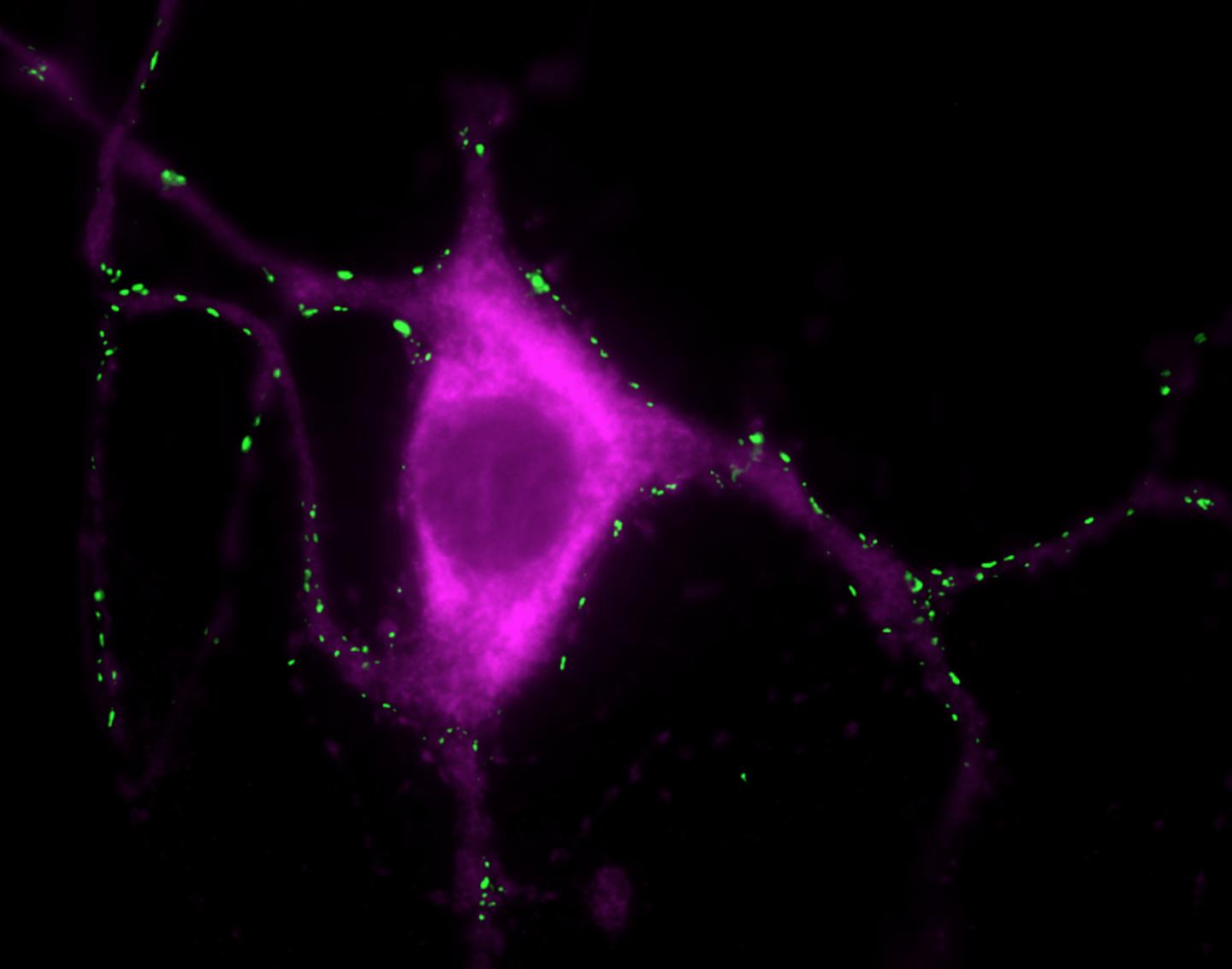 Tyrosine Hydroxylase Positive Neuron Stained With a Synaptic Marker