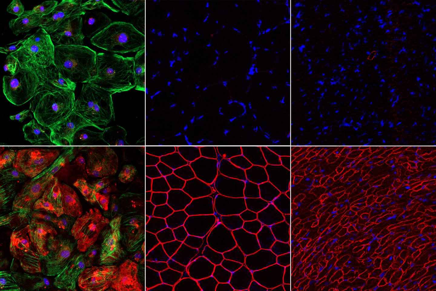 An Efficient Strategy to Edit Common Mutation that Causes Duchenne Muscular Dystrophy (1 of 5)