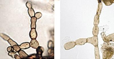 Living and Fossil Fungal Hyphae