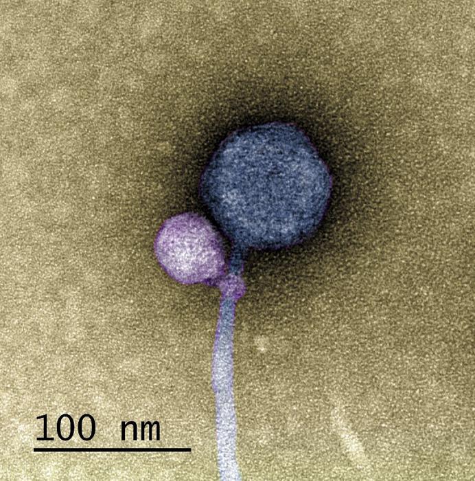 Discovery of first satellite virus bound to its helper virus