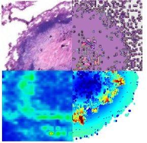 Tuberculosis Drug May Work Better than Others in its Class