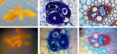 Smartphone vs. Traditional Microscope: Plant Matter