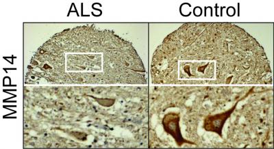 Representative Tissue Microarray Core