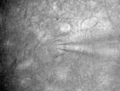 Inside the Cochlear Nucleus