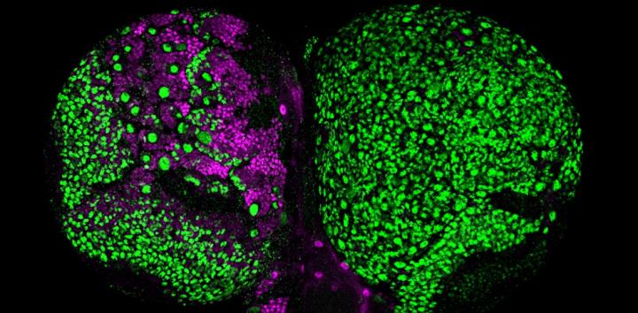 Tumorous vs. Healthy Fly Brain