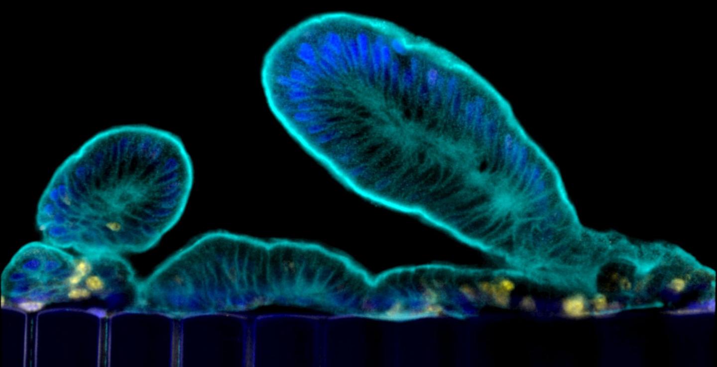 Primary Human Intestine Engineered On an Organ Chip