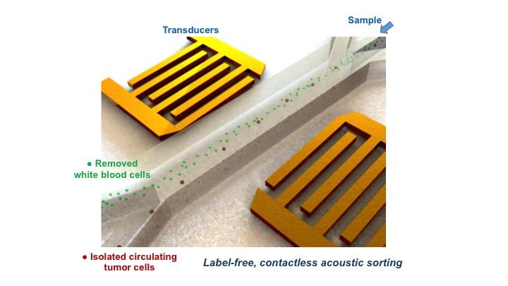 Microfluidic Chip Uses Sound Waves to Separate Circulating Tumor Cells from White Blood Cells