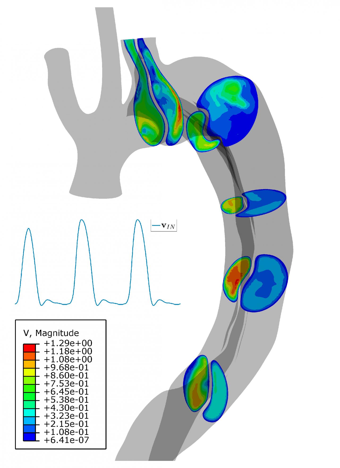 simulation blood flow