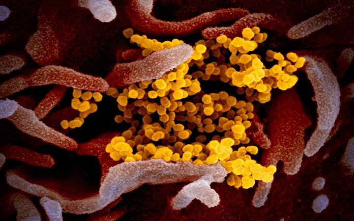 The novel coronavirus as seen under a microscope.