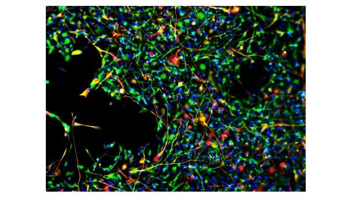 Neural stem cells