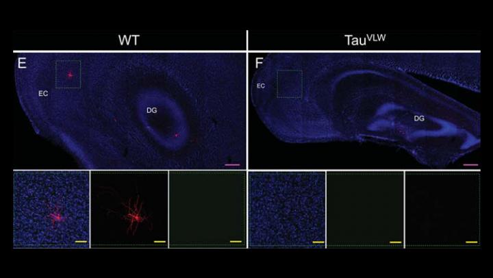 Hippocampus & Entorhinal Cortex