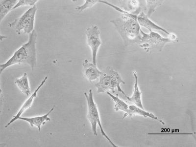 Starting Mesenchymal Cells