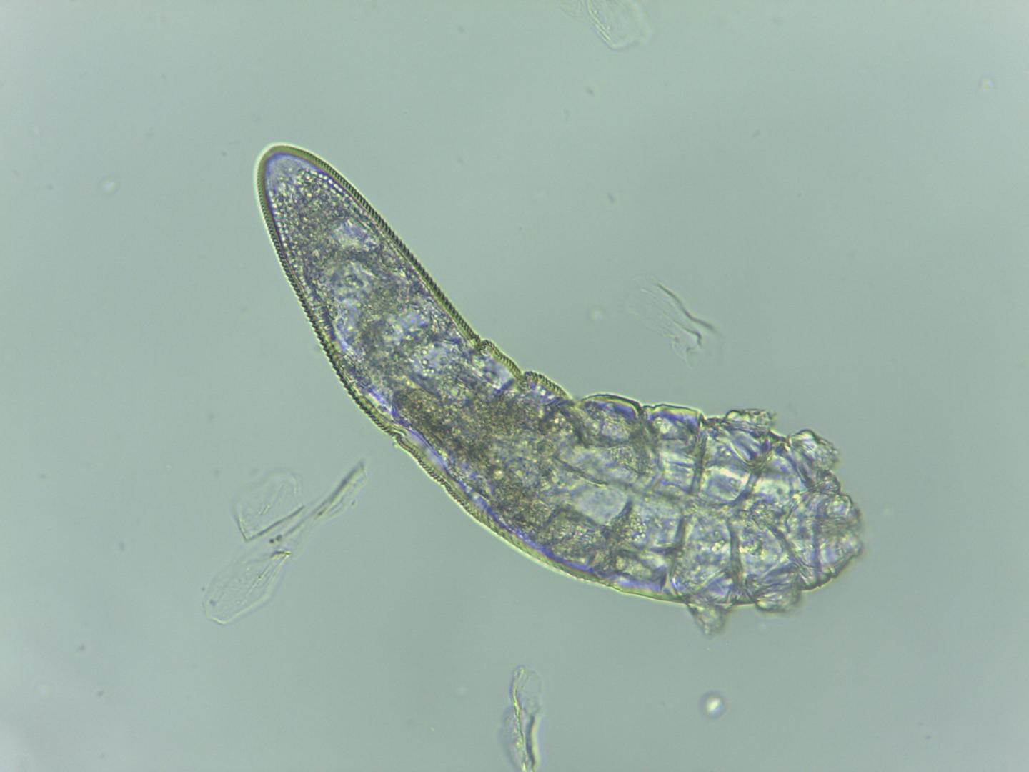 <i>Demodex folliculorum</i>