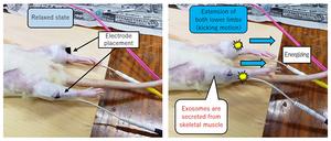 Release of skeletal muscle-derived exosomes