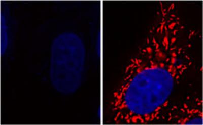 Mitochondrial Dysfunction