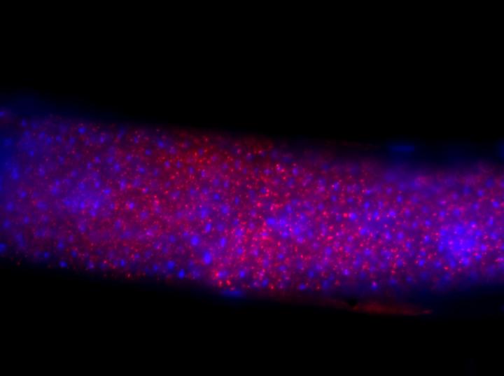 Male Caenorhabditis Nematode 
