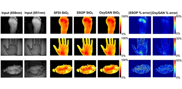 Comparison of profile-corrected SFDI, SSOP, and OxyGAN.