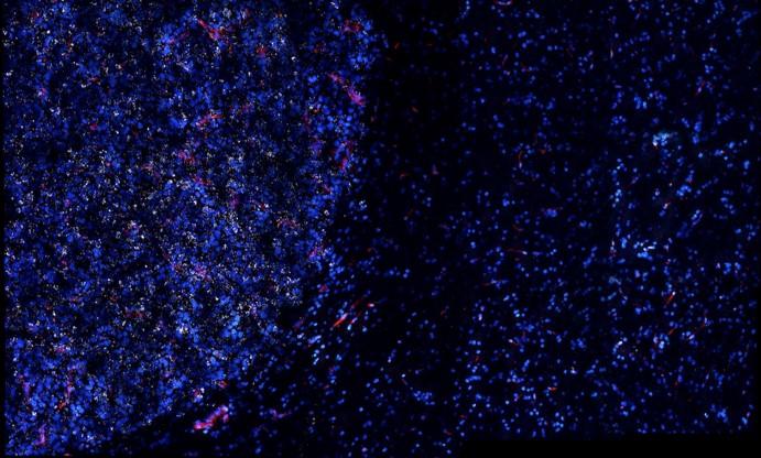 Nanostar Accumulation