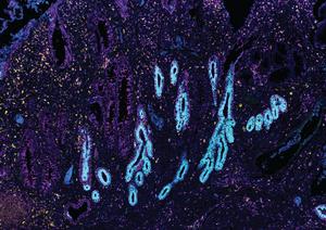 Human Intestinal tract in IBD (2)