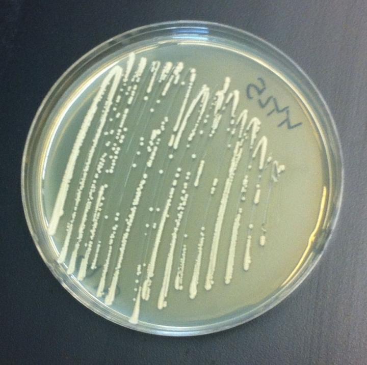 Yeast in a Petri Dish
