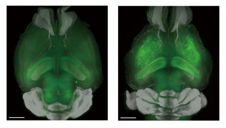 Figure 2: Increased Neural Excitability by Inhibition of NMDA Receptors