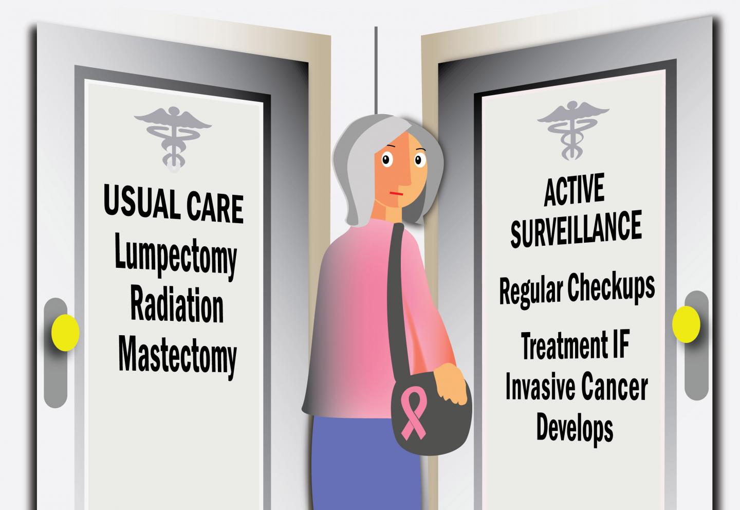 Mathematical Model Suggests Select DCIS Patients Could Delay Treatment