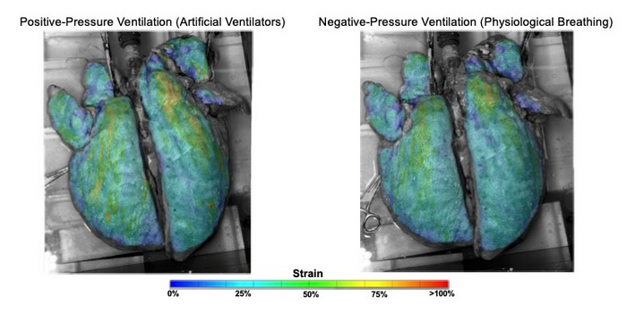 Strain maps