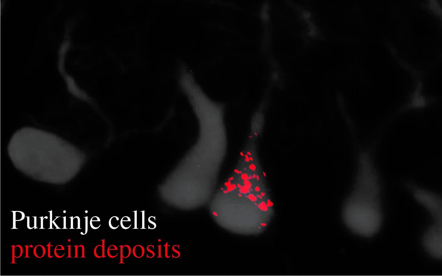 Purkinje Cells and Protein Deposits