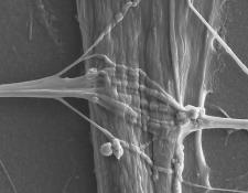 Scanning electron microscopy image of a human neuromuscular junction