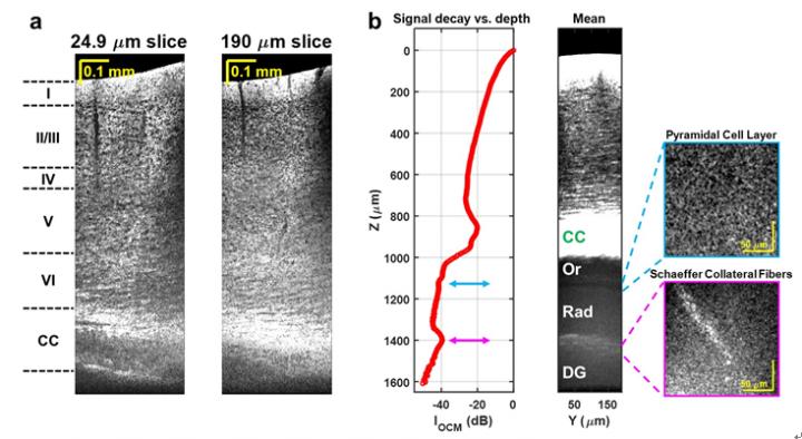 Figure 1. In vivo minimally invasive optical biopsy of the mouse brain with OCM.