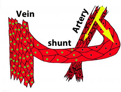 Controlling Inflated Blood Vessels (6 of 7)