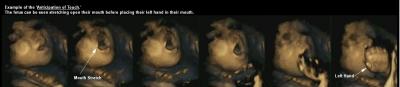 4-D Scan of Fetus at 32 Weeks