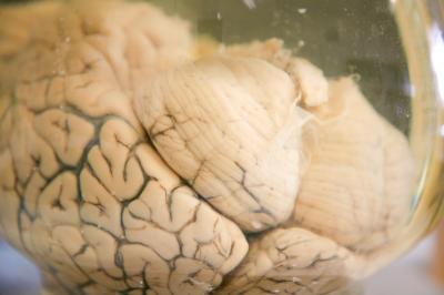 A Brain Sample