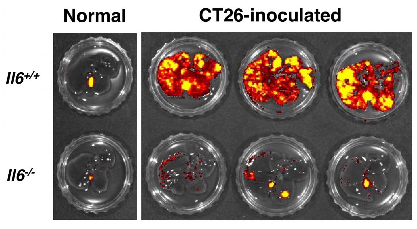 Tumorigenesis of Colorectal Cancer Cells