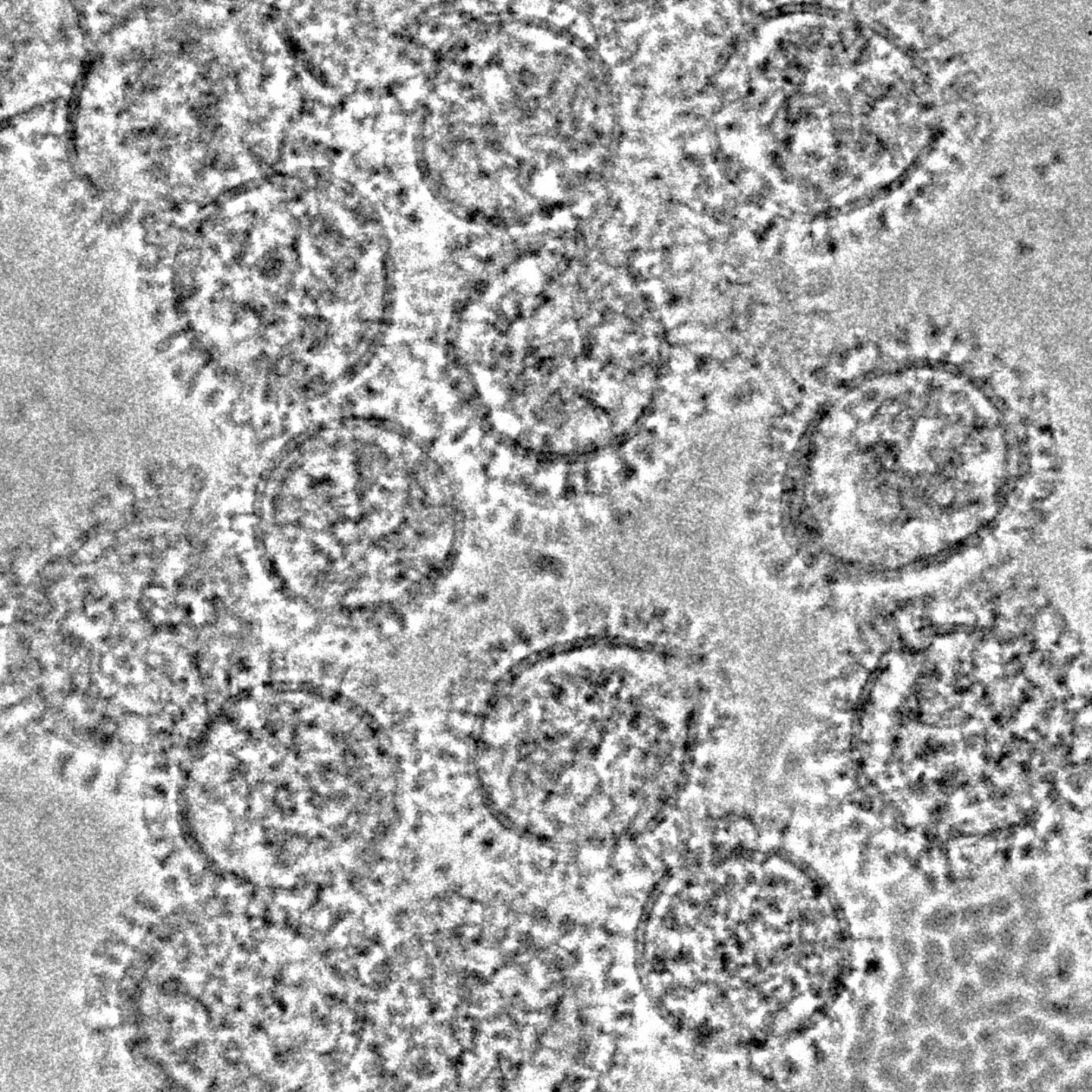 flu virus electron microscope