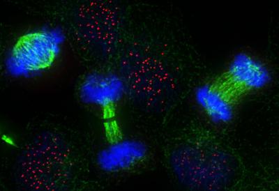 Cell Cycle Seen in Human Cancer Cells