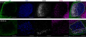 Microscopy image of a germinal centre structure which is altered in aged mice.