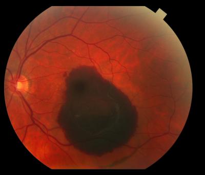 Normal Adult Mouse Retinal Vasculature