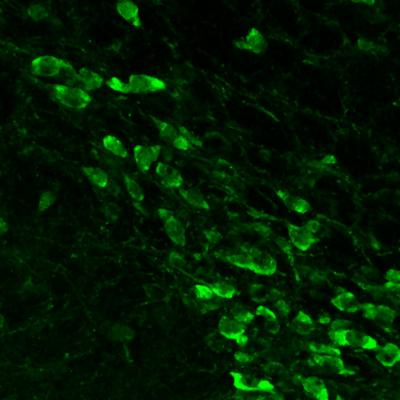 Dopamine Neurons Stained Green