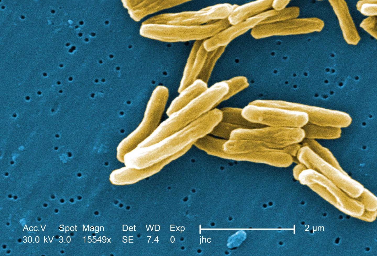 TB-Causing Bacteria
