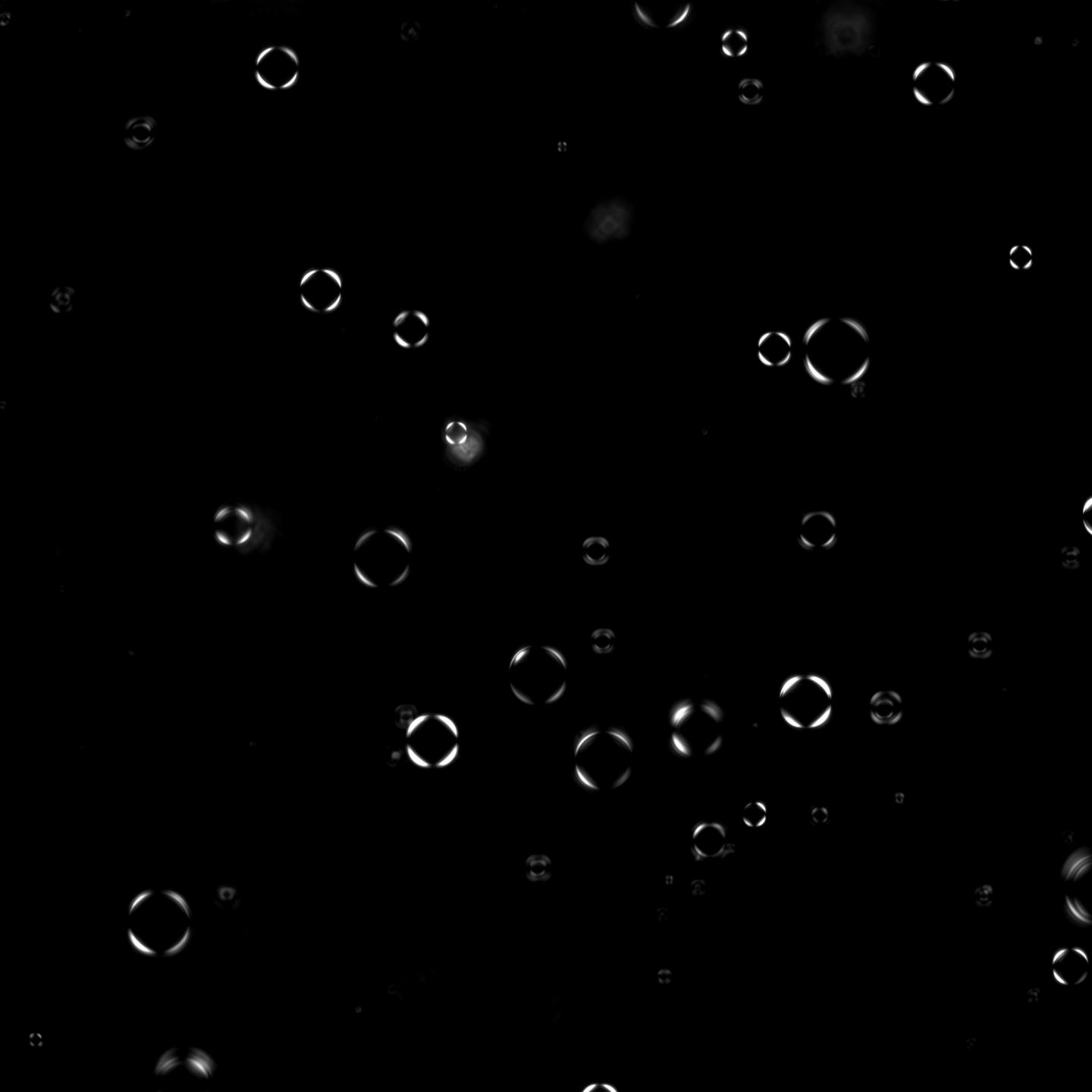 Protein-RNA vesicles (polarization microscopy)