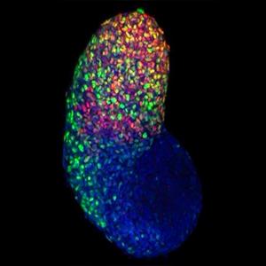 Visualizing gene expression