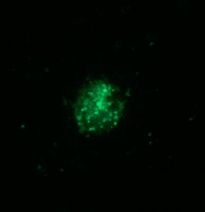 Compound in Broccoli Sprouts Cleans Out Diseased Lungs (1 of 2)