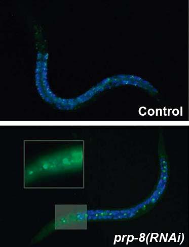 Researchers Create A Worm Model To Investigate A Rare Subtype Of Blindness