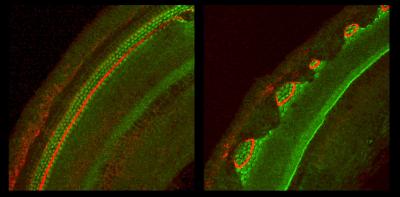 Partial Mouse Cochlea