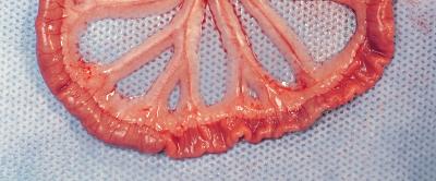 Treated Small Intestine