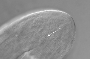Demodex folliculorum anus